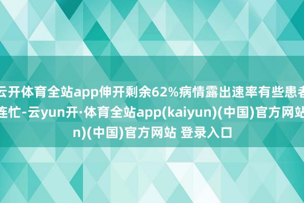 云开体育全站app伸开剩余62%病情露出速率有些患者病情露出连忙-云yun开·体育全站app(kaiyun)(中国)官方网站 登录入口